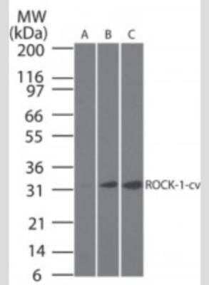 Western Blot: ROCK1 Antibody (154C1465)(active/cleaved)Azide Free [NBP2-33238]