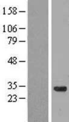 Western Blot: coiled-coil domain containing 53 Overexpression Lysate [NBL1-08804]