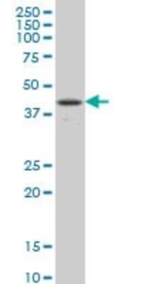 Western Blot: csl/RBPJK Antibody (4E12) [H00003516-M01]