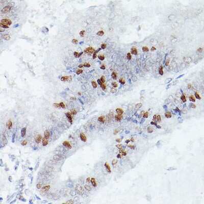 Immunohistochemistry-Paraffin: csl/RBPJK Antibody (9B3L6) [NBP3-16326]