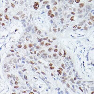 Immunohistochemistry-Paraffin: csl/RBPJK Antibody (9B3L6) [NBP3-16326]