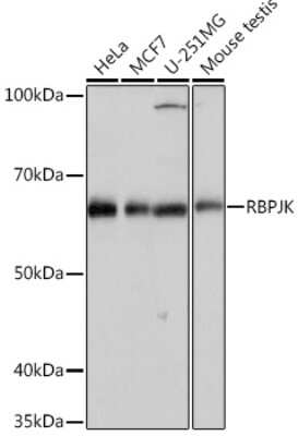 Western Blot: csl/RBPJK Antibody (9B3L6) [NBP3-16326]