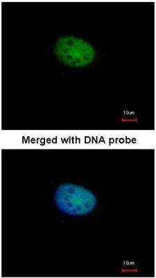 Immunocytochemistry/ Immunofluorescence: csl/RBPJK Antibody [NBP1-33427]
