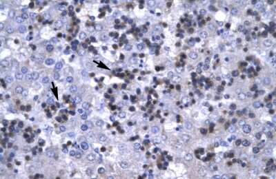 Immunohistochemistry: csl/RBPJK Antibody [NBP3-10894]