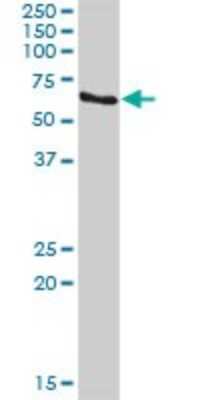 Western Blot: csl/RBPJK Antibody [H00003516-D01P]