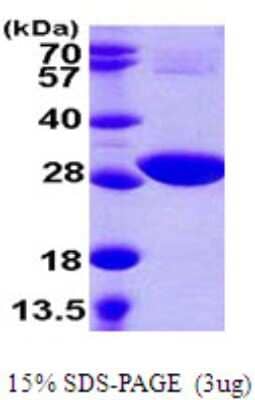 SDS-PAGE: Recombinant E. coli cysH His Protein [NBP2-22650]