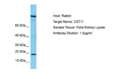 Western Blot: cystatin 11 Antibody [NBP2-82795]