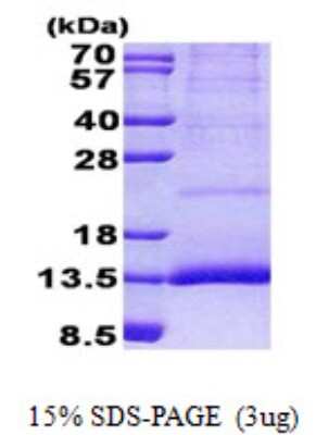 SDS-PAGE: Recombinant Human cystatin 11 His Protein [NBP2-22977]