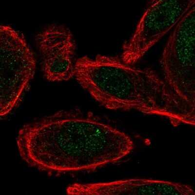 Immunocytochemistry/ Immunofluorescence: cysteine/histidine-rich 1 Antibody [NBP2-30428]