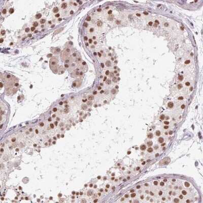 Immunohistochemistry-Paraffin: cysteine/histidine-rich 1 Antibody [NBP2-30428]