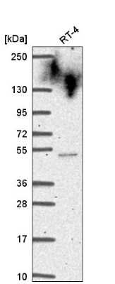 Western Blot: cysteine/histidine-rich 1 Antibody [NBP2-56486]