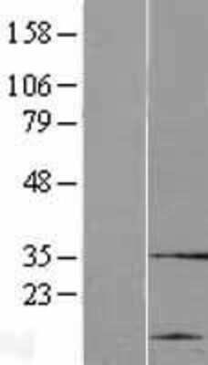 Western Blot: cysteine/histidine-rich 1 Overexpression Lysate [NBP2-04403]