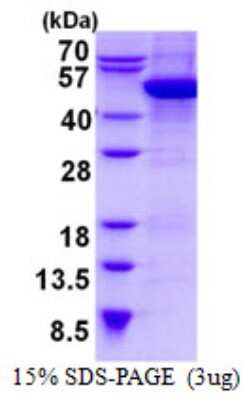 SDS-PAGE: Recombinant Human Cytohesin 2 His Protein [NBP2-22983]