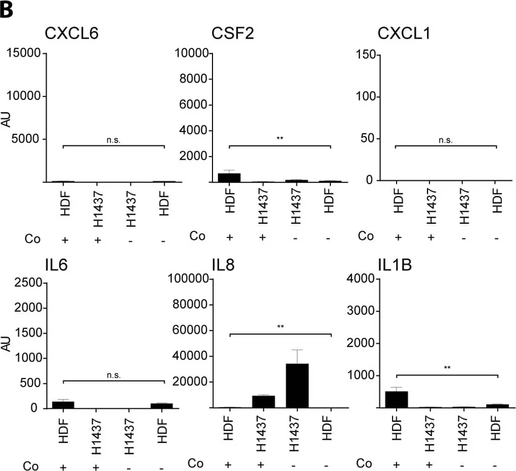 Human IL-8/CXCL8 Quantikine ELISA Kit