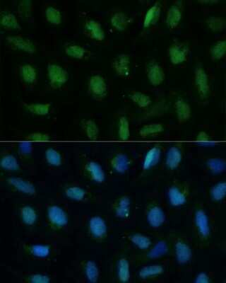 Immunocytochemistry/ Immunofluorescence: dUTPase Antibody - Azide and BSA Free [NBP2-92887]
