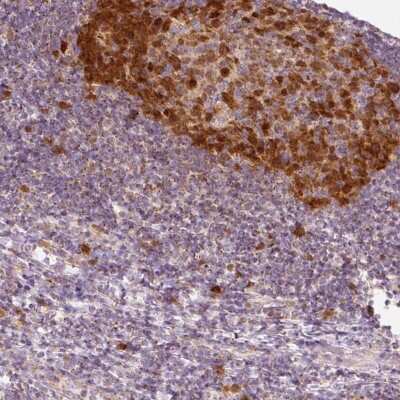 Immunohistochemistry: dUTPase Antibody [NBP2-33277]