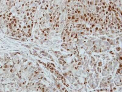 Immunohistochemistry-Paraffin: dUTPase Antibody [NBP2-16241]