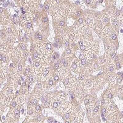 Immunohistochemistry-Paraffin: dUTPase Antibody [NBP2-33277]