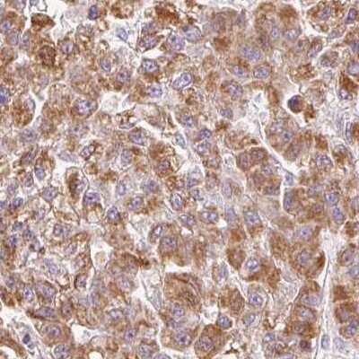 Immunohistochemistry-Paraffin: dUTPase Antibody [NBP2-33277]