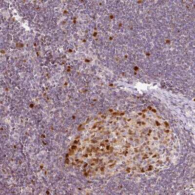 Immunohistochemistry-Paraffin: dUTPase Antibody [NBP2-33277]