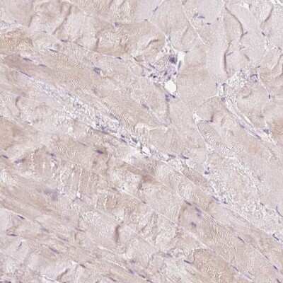 Immunohistochemistry-Paraffin: dUTPase Antibody [NBP2-33277]