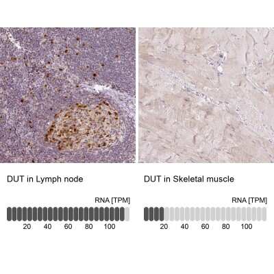 Immunohistochemistry-Paraffin: dUTPase Antibody [NBP2-33277]