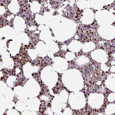 Immunohistochemistry-Paraffin: dUTPase Antibody [NBP2-47479]