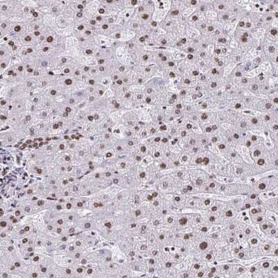 Immunohistochemistry-Paraffin: dUTPase Antibody [NBP2-47479]