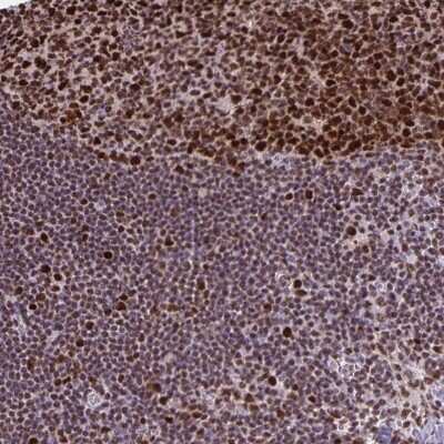 Immunohistochemistry-Paraffin: dUTPase Antibody [NBP2-47479]