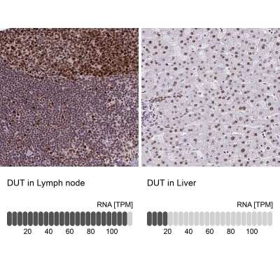 Immunohistochemistry-Paraffin: dUTPase Antibody [NBP2-47479]