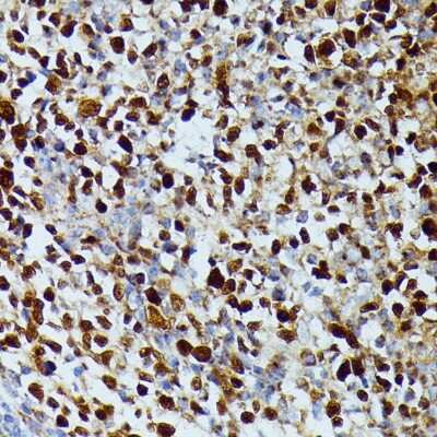 Immunohistochemistry-Paraffin: dUTPase Antibody - Azide and BSA Free [NBP2-92887]