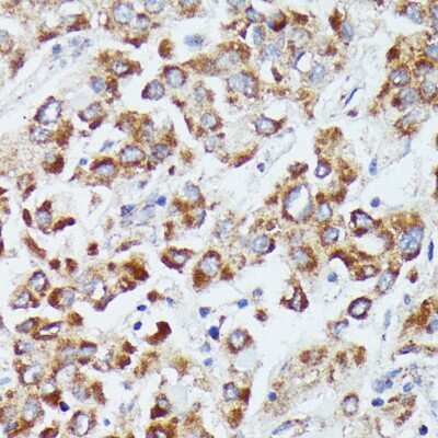 Immunohistochemistry-Paraffin: dUTPase Antibody - Azide and BSA Free [NBP2-92887]