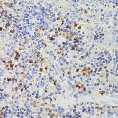 Immunohistochemistry-Paraffin: dUTPase Antibody - Azide and BSA Free [NBP2-92887]