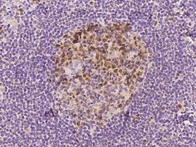 Immunohistochemistry-Paraffin: dUTPase Antibody [NBP2-97744]