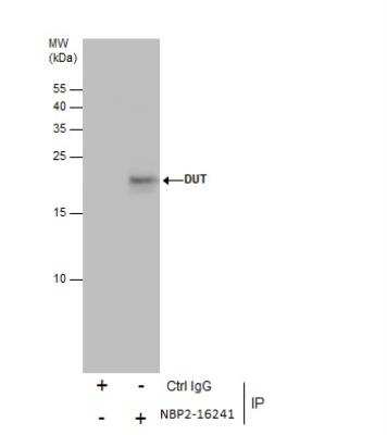 Immunoprecipitation: dUTPase Antibody [NBP2-16241]