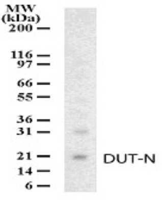 Western Blot: dUTPase Antibody [NB100-56624]