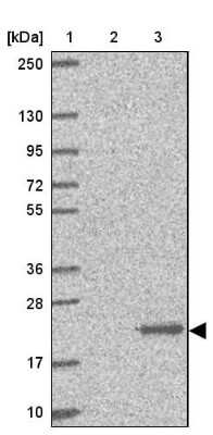 Western Blot: dUTPase Antibody [NBP2-33277]