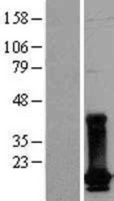 Western Blot: dUTPase Overexpression Lysate [NBL1-10060]