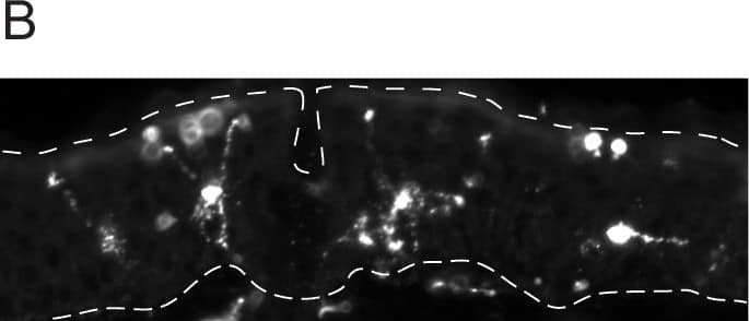 Langerin/CD207 Antibody (929F3.01)