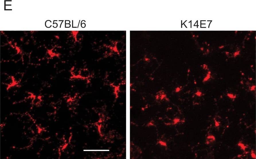 Langerin/CD207 Antibody (929F3.01)