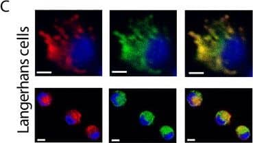 Langerin/CD207 Antibody (DCGM4/122D5)