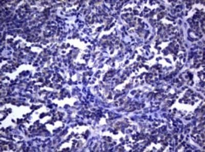 Immunohistochemistry: dedicator of cytokinesis 8 Antibody (OTI12D7) [NBP2-46470]