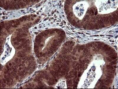 Immunohistochemistry: dedicator of cytokinesis 8 Antibody (OTI4F3) [NBP2-46469]