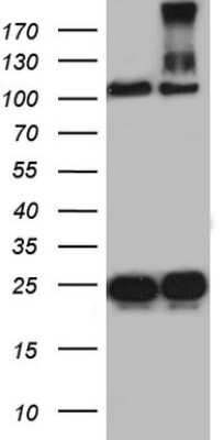 Western Blot: dedicator of cytokinesis 8 Antibody (OTI4H10) [NBP2-46471]