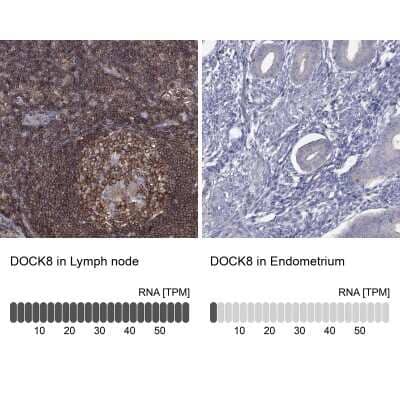 Immunohistochemistry-Paraffin: dedicator of cytokinesis 8 Antibody [NBP3-17049]