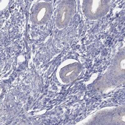 Immunohistochemistry-Paraffin: dedicator of cytokinesis 8 Antibody [NBP3-17049]