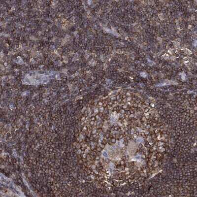 Immunohistochemistry-Paraffin: dedicator of cytokinesis 8 Antibody [NBP3-17049]
