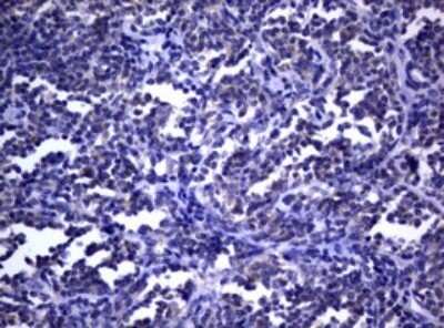 Immunohistochemistry: dedicator of cytokinesis 8 Antibody (OTI12D7) - Azide and BSA Free [NBP2-72227]