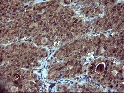 Immunohistochemistry: dedicator of cytokinesis 8 Antibody (OTI4F3) - Azide and BSA Free [NBP2-72226]