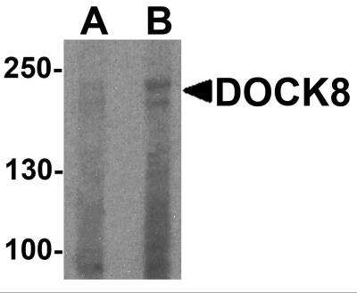 Western Blot: dedicator of cytokinesis 8 AntibodyBSA Free [NBP2-82084]